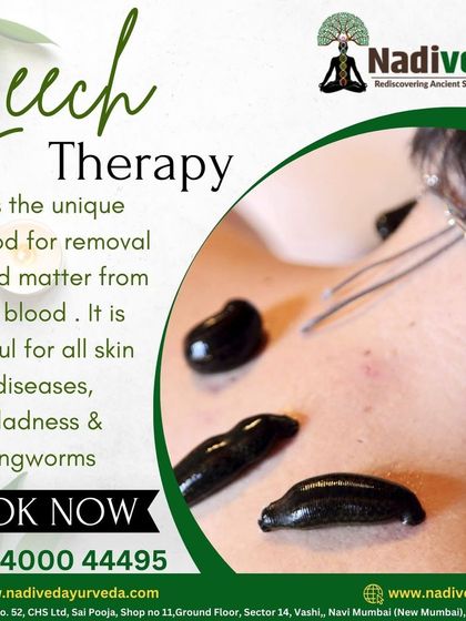 Leech therapy, or Raktamokshana, is a unique and powerful Ayurvedic method for blood purification. It is highly effective for stubborn skin diseases, baldness, and other conditions caused by impure blood.