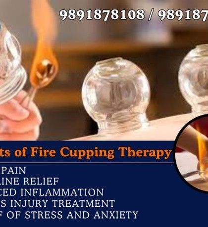 This is Fire Cupping, a traditional technique that uses heat to create strong suction. It is highly effective for relieving joint pain, reducing inflammation, and even helping with stress and anxiety. We ensure this is performed safely by experienced therapists.