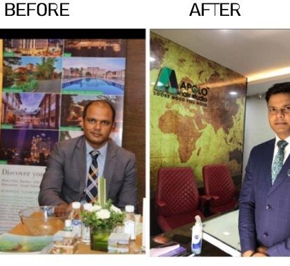 Our goal is to help you feel your best, and this transformation is a perfect example. This client's professional look was enhanced by restoring his hair, proving our philosophy that when you look good, you feel good.