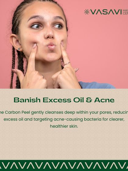 Sree Vasavi - Acne & Scar Treatment Skin Rejuvenation & Maintenance photo 5