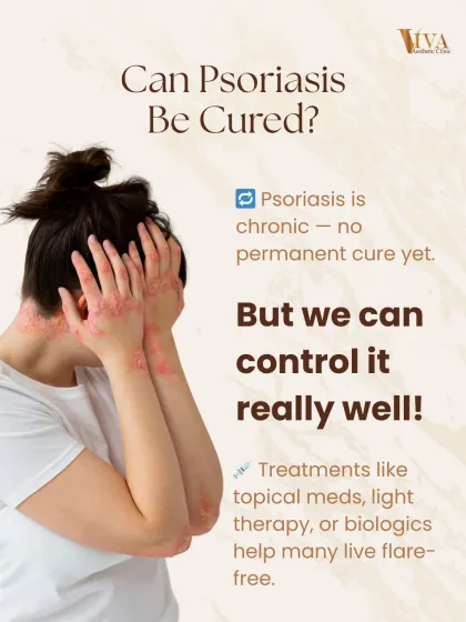 A common question is, "Can psoriasis be cured?" While there is no permanent cure yet because it is a chronic condition, we have excellent treatments like topical meds, light therapy, and biologics that can control it very well, allowing many to live flare-free.