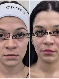Anti-Aging & Injectables