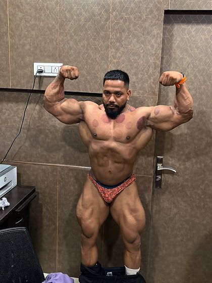 Front double bicep pose showing the cupping marks. This is part of the process.