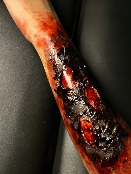 This shot captures the raw, open wounds within the larger burn prosthetic. Each detail is meticulously crafted to tell a story of injury, making the effect more believable and impactful for the audience.