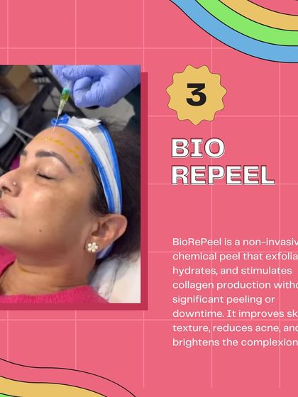 BioRePeel is a fantastic option for those who want the benefits of a chemical peel without the downtime. It improves skin texture, reduces acne, and brightens the complexion.
