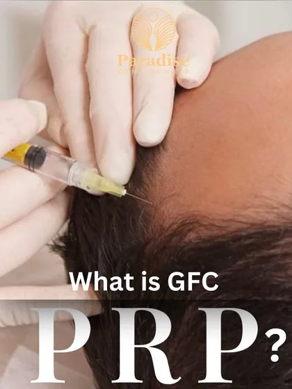 A close-up of the GFC PRP (Growth Factor Concentrate Platelet-Rich Plasma) treatment. This procedure uses your body's own concentrated growth factors, which I inject into the scalp to rejuvenate follicles, reduce hair fall, and stimulate new, stronger hair.