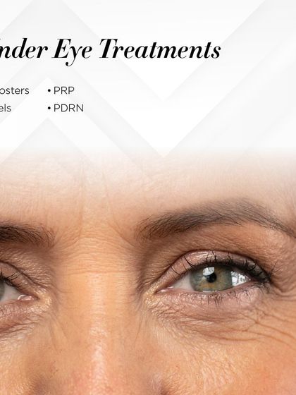 I offer a range of treatments to rejuvenate the delicate under-eye area. This graphic lists some of the options, including boosters, PRP, peels, and PDRN, each designed to address specific concerns like dark circles or fine lines.