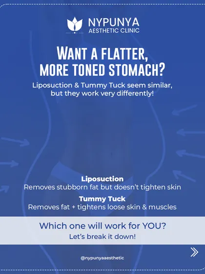 Many patients ask about the difference between a tummy tuck and liposuction. Liposuction is excellent for removing stubborn fat if your skin is firm, while a tummy tuck is designed to remove excess skin and tighten separated abdominal muscles, often after pregnancy or weight loss.