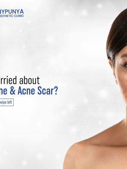 Are you worried about your acne and the scars it might leave behind? Let's address both with a comprehensive treatment plan.