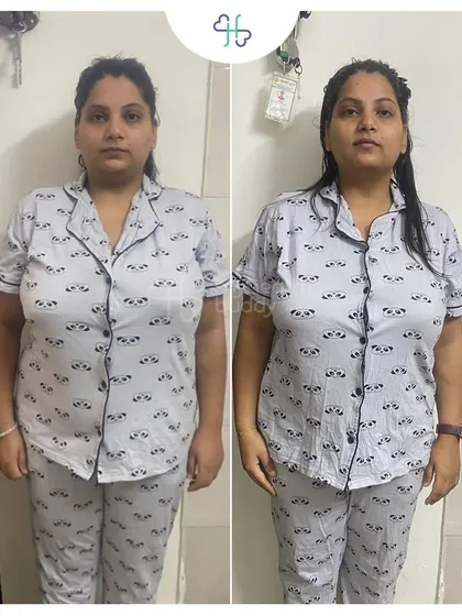 A front view of Vidhi's 7 kg weight loss. She became more active and improved her posture, all thanks to a consistent and supportive coaching plan.