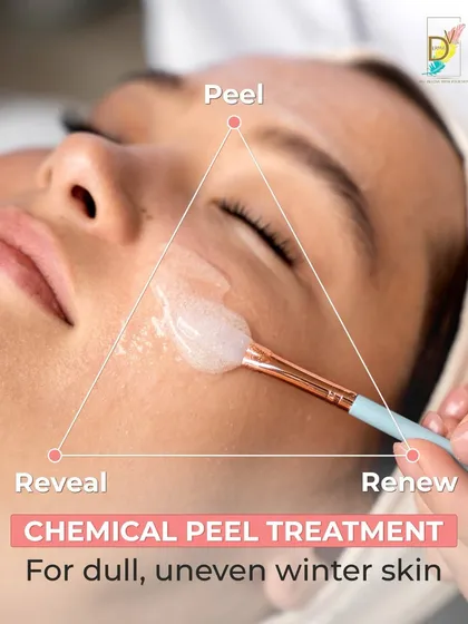 A chemical peel is a highly effective, controlled way to renew the skin. I customize every peel based on the skin's type, sensitivity, and specific concerns like acne marks or uneven tone. This process removes the damaged outer layers to reveal the smoother, healthier skin underneath.