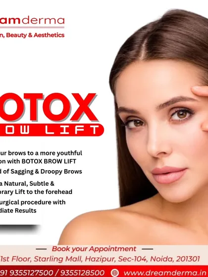 A Botox Brow Lift is a non-surgical procedure that gives a natural and subtle lift to the forehead, getting rid of sagging or droopy brows for a more awake appearance.