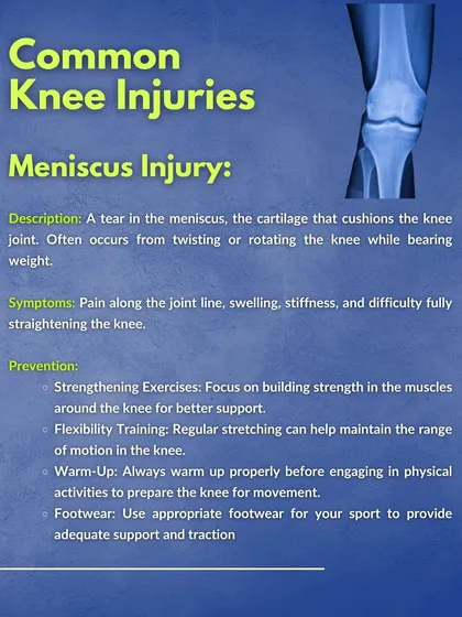 An explanation of a Meniscus Injury, a tear in the cartilage that cushions the knee joint. Prevention focuses on strengthening surrounding muscles, maintaining flexibility, and using proper footwear.