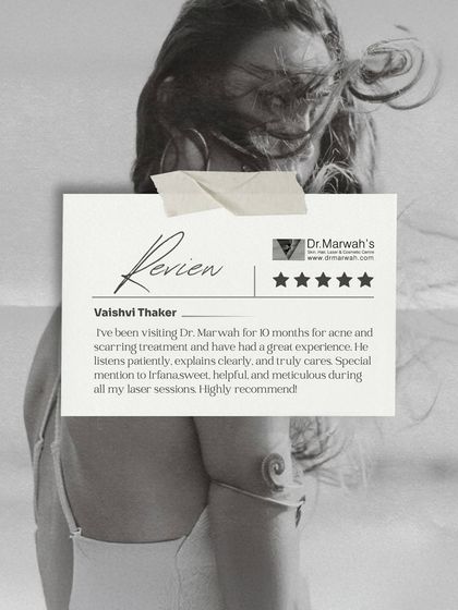 This review from a patient treated for acne and scarring emphasizes our approach to care. We prioritize listening to our patients, explaining the treatment process clearly, and ensuring every session is conducted with meticulous attention to detail.