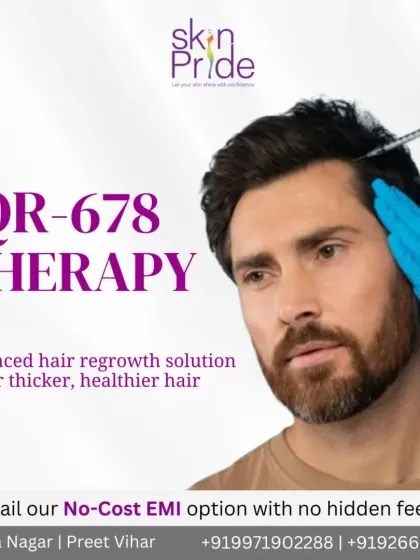 We offer the latest in non-surgical hair regrowth with QR-678 Therapy. This advanced solution is highly effective for improving hair density and thickness, giving you healthier and fuller hair. We also offer no-cost EMI options to make it more accessible.
