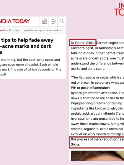In this feature for India Today, I explained the dermatological approach to treating post-inflammatory hyperpigmentation, commonly known as post-acne marks and dark spots.