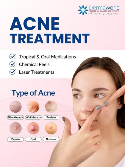 Acne is not a single condition; it includes blackheads, whiteheads, papules, cysts, and more. This infographic helps you identify different types of acne, as each requires a specific treatment approach, from topical medications to laser therapies.