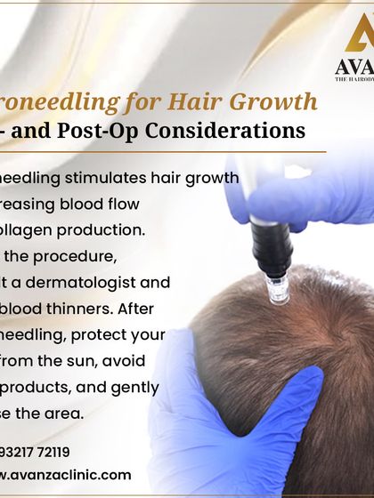 Microneedling is a minimally invasive procedure that stimulates hair growth by increasing blood flow and collagen production in the scalp. We always advise consulting with us before the procedure and following post-op care like sun protection.