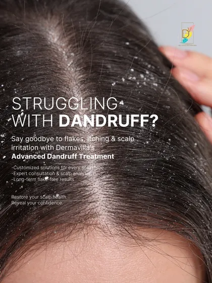 Dandruff is a common but frustrating problem that can affect your confidence. This image shows the visible flakes that many people struggle with. My approach is to provide customized, long-term solutions that address the root cause, so you can enjoy a healthy, flake-free scalp.
