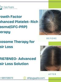 Hair Restoration & Scalp Health