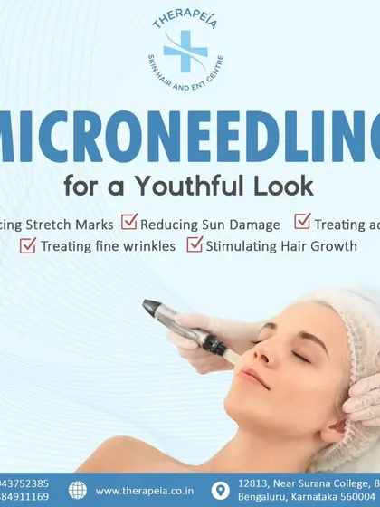 Microneedling is a versatile treatment I use for various concerns. It helps reduce acne scars and stretch marks, treats fine wrinkles, and can even stimulate hair growth by promoting the skin's natural healing and collagen production.