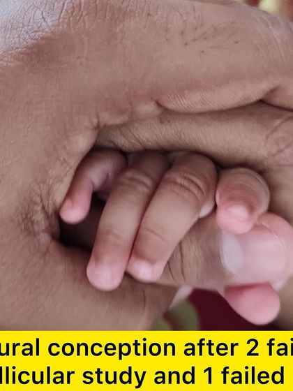 The beautiful result of a long struggle. A healthy baby boy born after 2 failed follicular studies and 1 failed IUI.