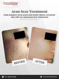 Aesthetic Dermatology