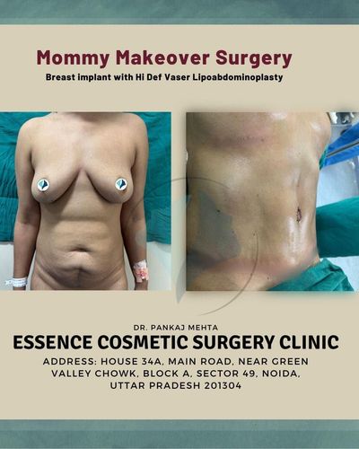 Mommy Makeover