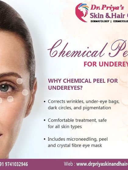 Priya J Talageri - Anti-Aging & Skin Tightening Chemical Peels & Advanced Facials photo 9