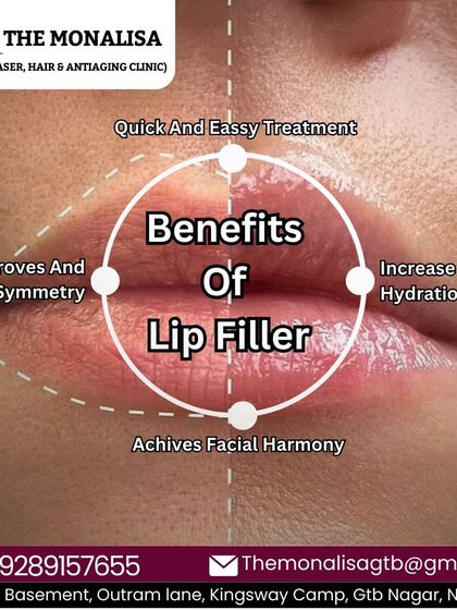 This graphic explains the benefits of lip fillers, which include creating symmetry, increasing lip hydration for a smoother look, and achieving overall facial harmony. It's a quick and easy treatment with immediate results.