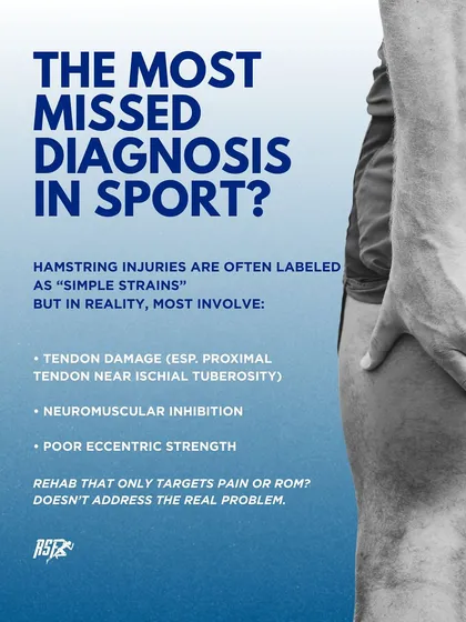 Hamstring injuries are often misdiagnosed as simple strains. In reality, they can involve tendon damage and neuromuscular inhibition. Rehab that only targets pain or range of motion misses the real problem.