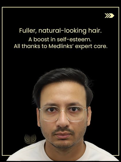 The final result: fuller, natural-looking hair and a major boost in self-esteem, all thanks to our expert care.