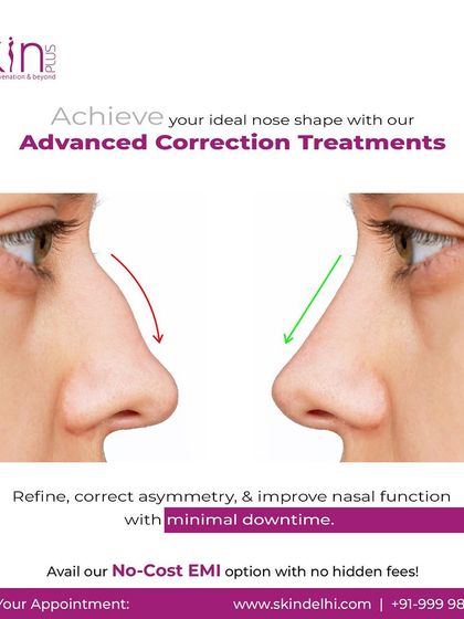 Wrinkle Reduction: Botox & Fillers photo 20