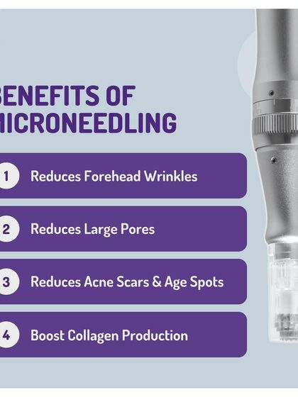 Here is a quick look at the powerful benefits of microneedling. This treatment is a go-to for reducing forehead wrinkles, minimizing large pores, fading acne scars, and boosting natural collagen production.