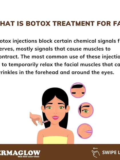 This graphic explains the science behind Botox. The injections work by temporarily blocking nerve signals to the muscles, causing them to relax. This is most commonly used to smooth wrinkles on the forehead and around the eyes.