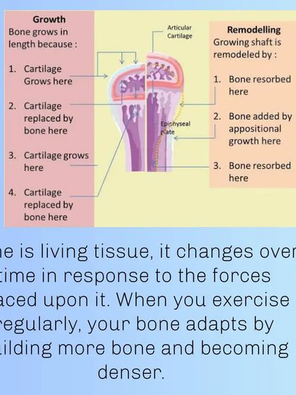 An illustration of how bone remodels itself in response to stress. When you exercise, your bone adapts by building more bone and becoming denser.