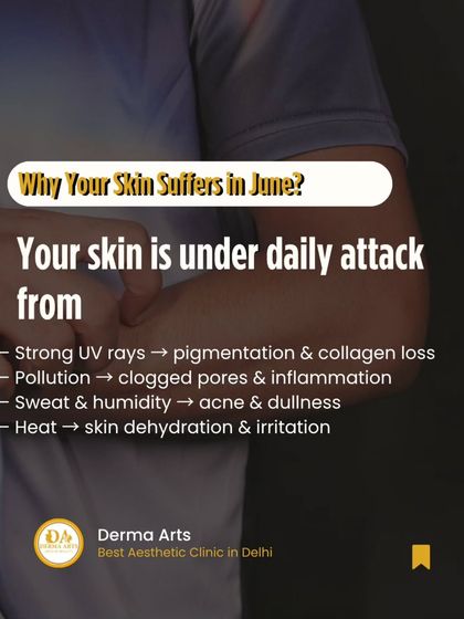 Why your skin suffers in June. This image explains how UV rays, pollution, and sweat contribute to pigmentation, clogged pores, and dehydration.