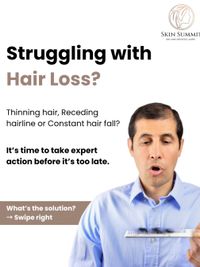 Hair Restoration Treatments