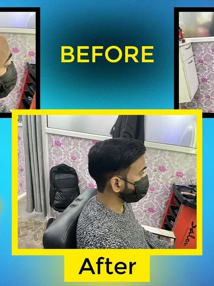 From consultation to the final look, this image shows the result of my complete hair patch service. The final style is neat, clean, and looks totally real.
