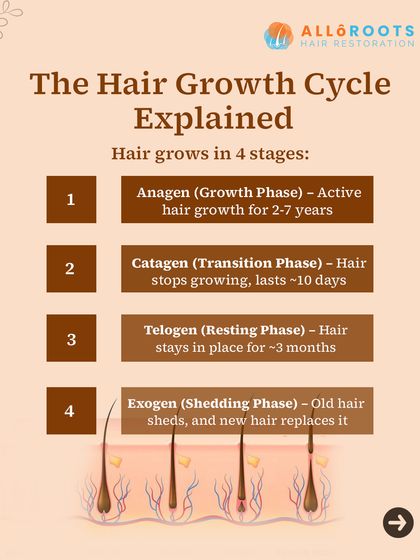 Your hair grows in four distinct stages: Anagen (growth), Catagen (transition), Telogen (resting), and Exogen (shedding). Understanding this cycle is fundamental to diagnosing why hair loss occurs and how to treat it effectively.