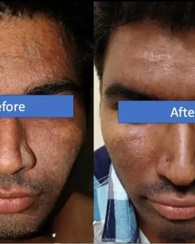 Medical Dermatology