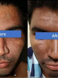 Advanced Facials & Skin Rejuvenation