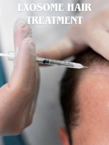 This graphic explains the key benefits of Exosome hair treatment. It is a powerful non-surgical option that reduces hair fall, promotes new baby hair, and thickens existing strands for both men and women.