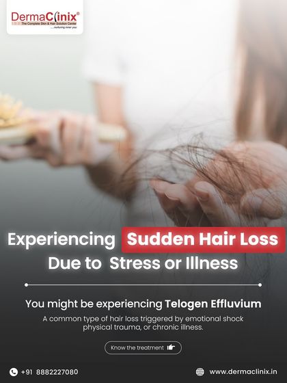 Experiencing sudden, excessive hair shedding after a stressful event or illness? You might have Telogen Effluvium, a common and treatable condition.