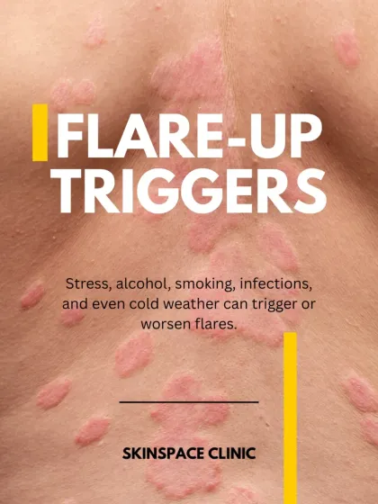 Flare-ups can be triggered by many factors, including stress, alcohol, and even cold weather. Part of my management plan is helping you identify and manage these triggers to reduce the frequency and severity of outbreaks.