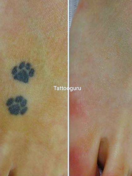 Two small paw prints removed from the top of the foot. I can work on various body parts, including feet and hands.