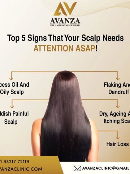 Your scalp's health is the foundation for healthy hair. This visual guide shows five key signs that your scalp needs attention, including excess oil, dandruff, redness, itching, or visible hair loss.