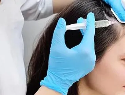 This image shows a patient receiving PRP injections. The procedure is performed with precision to ensure the platelet-rich plasma is delivered effectively to the target areas of the scalp.