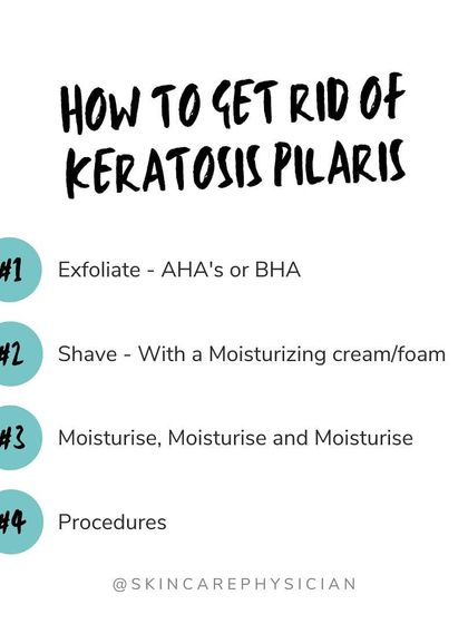The four key steps to managing Keratosis Pilaris are: exfoliate with AHAs or BHAs, shave gently, moisturize consistently, and consider in-office procedures for resistant cases.
