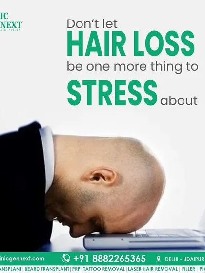 Don't let hair loss be one more thing to stress about. I offer effective and permanent solutions so you can focus on what truly matters.